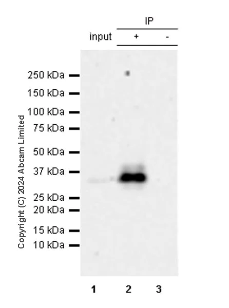 Immunoprecipitation - Anti-PVRIG/CD112R antibody [EPR29052-91] (AB322348)