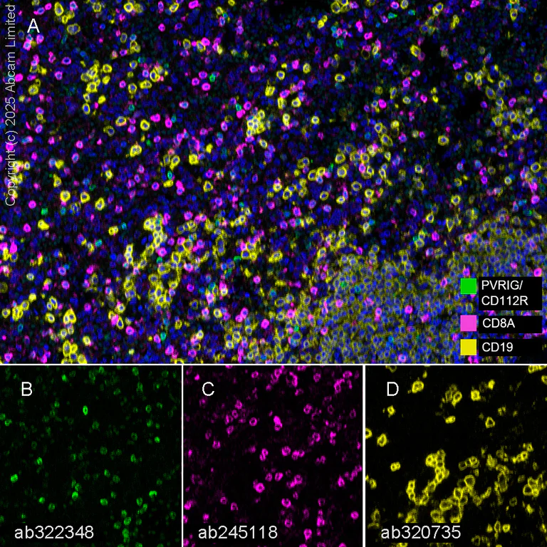 Multiplex immunohistochemistry - Anti-PVRIG/CD112R antibody [EPR29052-91] (AB322348)