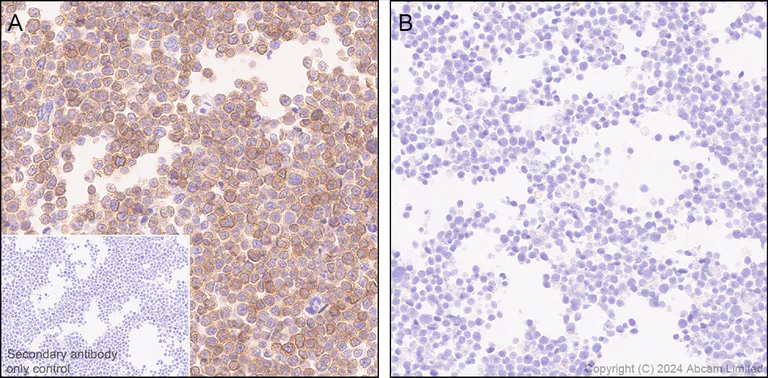 Immunohistochemistry (Formalin/PFA-fixed paraffin-embedded sections) - Anti-PVRIG/CD112R antibody [EPR29052-91] - BSA and Azide free (AB324789)