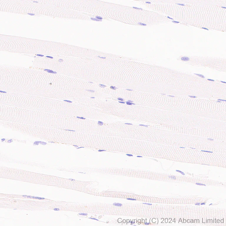 Immunohistochemistry (Formalin/PFA-fixed paraffin-embedded sections) - Anti-PVRIG/CD112R antibody [EPR29052-91] - BSA and Azide free (AB324789)