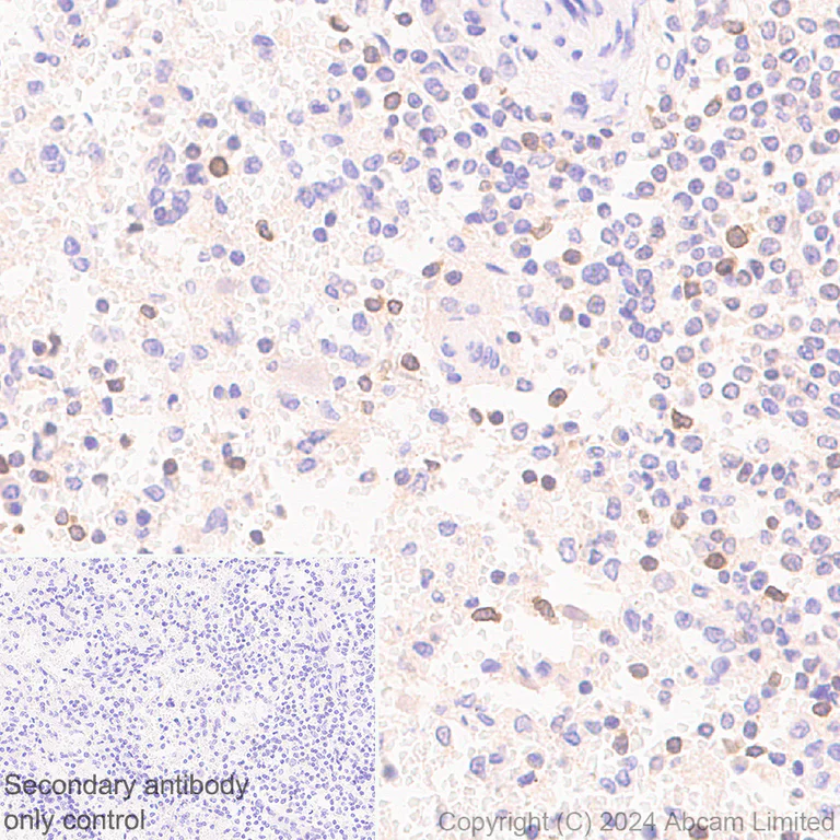 Immunohistochemistry (Formalin/PFA-fixed paraffin-embedded sections) - Anti-PVRIG/CD112R antibody [EPR29052-91] - BSA and Azide free (AB324789)