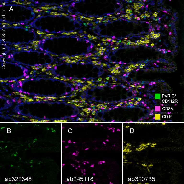 Multiplex immunohistochemistry - Anti-PVRIG/CD112R antibody [EPR29052-91] - BSA and Azide free (AB324789)