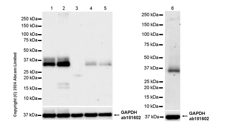 Western blot - Anti-PVRIG/CD112R antibody [EPR29052-91] - BSA and Azide free (AB324789)