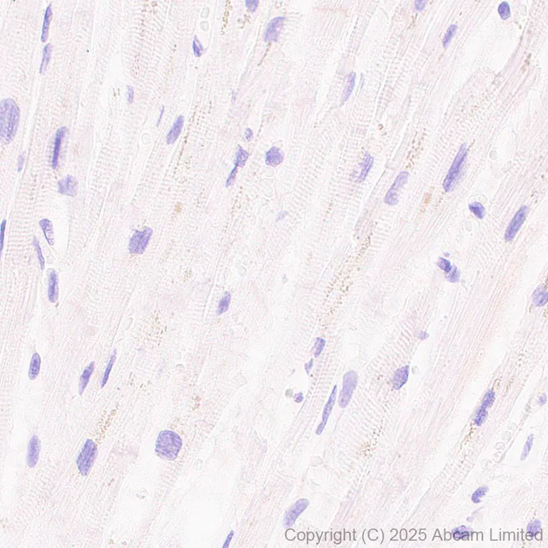 Immunohistochemistry (Formalin/PFA-fixed paraffin-embedded sections) - Anti-PVRL1/NECTIN1 antibody [EPR29038-520] (AB323704)