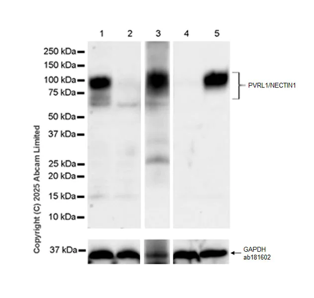 Western blot - Anti-PVRL1/NECTIN1 antibody [EPR29038-520] (AB323704)