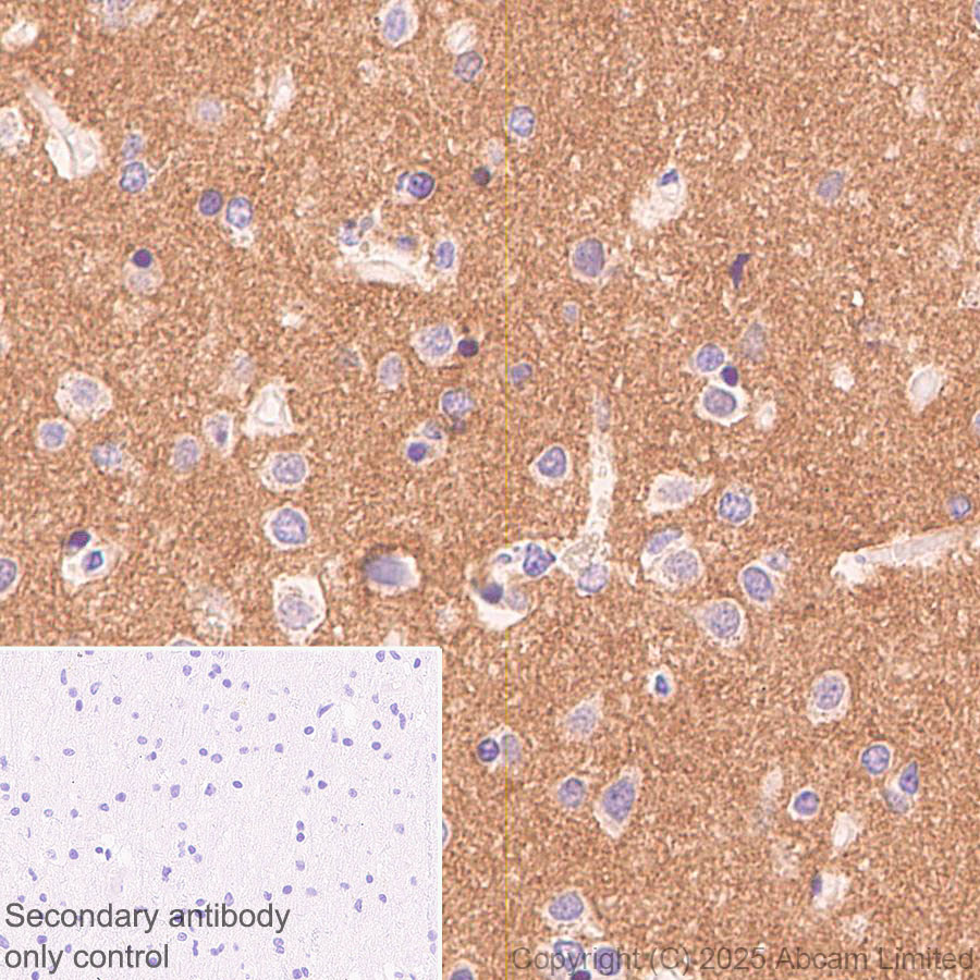 Immunohistochemistry (Formalin/PFA-fixed paraffin-embedded sections) - Anti-PVRL1/NECTIN1 antibody [EPR29038-520] - BSA and Azide free (ab323705), expandable thumbnail