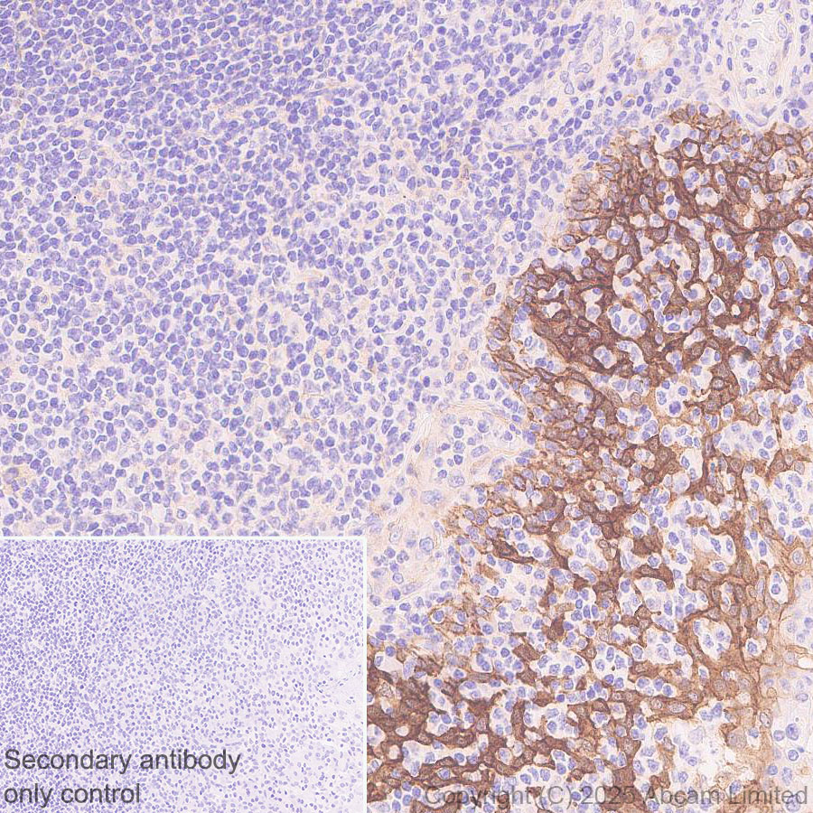 Immunohistochemistry (Formalin/PFA-fixed paraffin-embedded sections) - Anti-PVRL1/NECTIN1 antibody [EPR29038-520] - BSA and Azide free (AB323705), expandable thumbnail