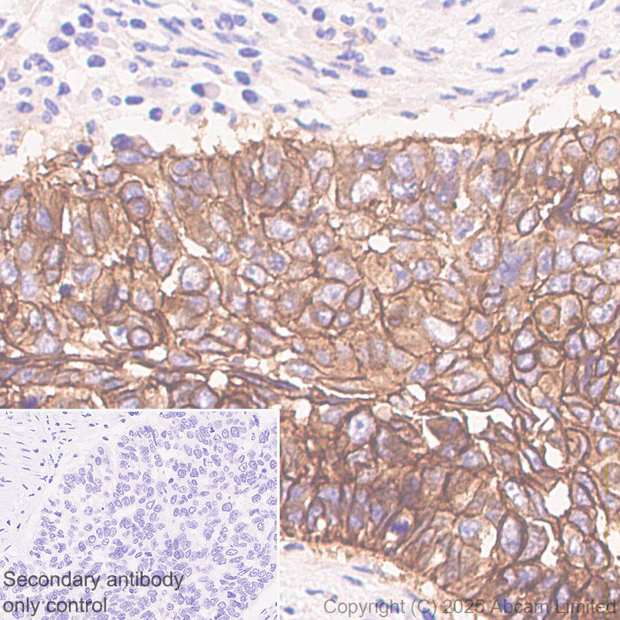 Immunohistochemistry (Formalin/PFA-fixed paraffin-embedded sections) - Anti-PVRL1/NECTIN1 antibody [EPR29038-520] - BSA and Azide free (AB323705), expandable thumbnail