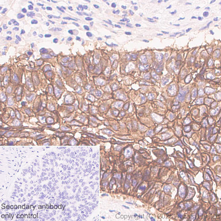 Immunohistochemistry (Formalin/PFA-fixed paraffin-embedded sections) - Anti-PVRL1/NECTIN1 antibody [EPR29038-520] - BSA and Azide free (AB323705)