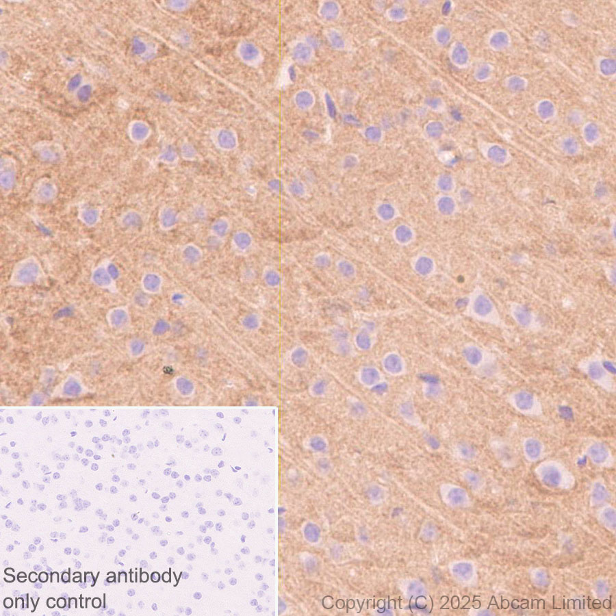 Immunohistochemistry (Formalin/PFA-fixed paraffin-embedded sections) - Anti-PVRL1/NECTIN1 antibody [EPR29038-520] - BSA and Azide free (AB323705), expandable thumbnail