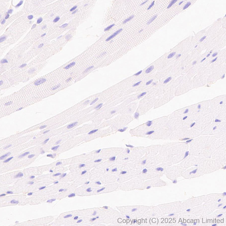 Immunohistochemistry (Formalin/PFA-fixed paraffin-embedded sections) - Anti-PVRL1/NECTIN1 antibody [EPR29038-520] - BSA and Azide free (AB323705), expandable thumbnail