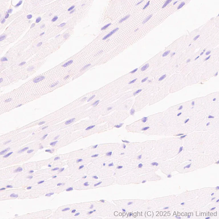 Immunohistochemistry (Formalin/PFA-fixed paraffin-embedded sections) - Anti-PVRL1/NECTIN1 antibody [EPR29038-520] - BSA and Azide free (AB323705)