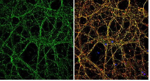 Immunocytochemistry/ Immunofluorescence - Anti-PVRL1/NECTIN1 antibody - N-terminal (AB229464)
