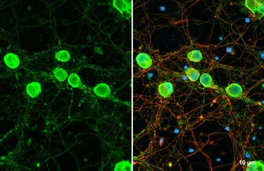 Immunocytochemistry/ Immunofluorescence - Anti-PVRL1/NECTIN1 antibody - N-terminal (AB229464)