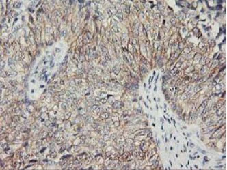 Immunohistochemistry (Formalin/PFA-fixed paraffin-embedded sections) - Anti-PVRL1/NECTIN1 antibody [OTI6F8] (AB279364)