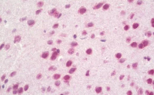 Immunohistochemistry (Formalin/PFA-fixed paraffin-embedded sections) - Anti-PXK antibody (AB230514)
