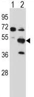 Western blot - Anti-PXK antibody (AB230514)