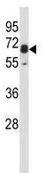 Western blot - Anti-PXK antibody (AB230514)
