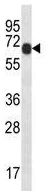 Western blot - Anti-PXK antibody (AB230514)