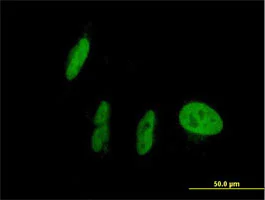 Immunocytochemistry/ Immunofluorescence - Anti-PXR antibody (AB118336)