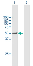 Western blot - Anti-PXR antibody (AB118336)