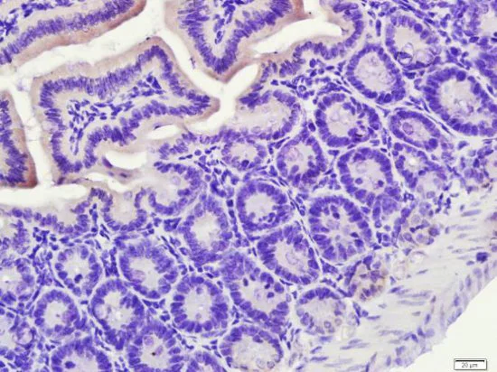 Immunohistochemistry (Formalin/PFA-fixed paraffin-embedded sections) - Anti-PXR antibody (AB217375)