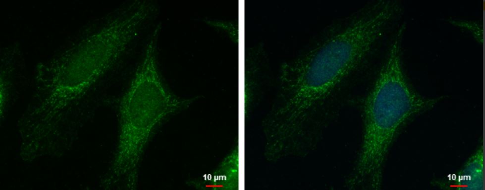 Immunocytochemistry/ Immunofluorescence - Anti-PYCR1 antibody (AB102601), expandable thumbnail