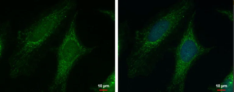 Immunocytochemistry/ Immunofluorescence - Anti-PYCR1 antibody (AB102601)