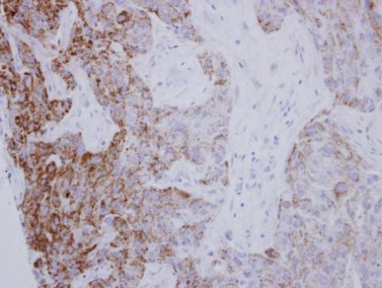 Immunohistochemistry (Formalin/PFA-fixed paraffin-embedded sections) - Anti-PYCR1 antibody (AB102601), expandable thumbnail