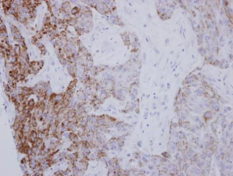 Immunohistochemistry (Formalin/PFA-fixed paraffin-embedded sections) - Anti-PYCR1 antibody (AB102601)