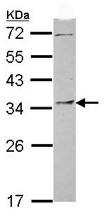Western blot - Anti-PYCR1 antibody (AB102601), expandable thumbnail