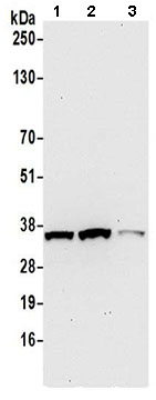Western blot - Anti-PYCR1 antibody (AB206693)