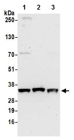 Western blot - Anti-PYCR1 antibody - C-terminal (AB226340)