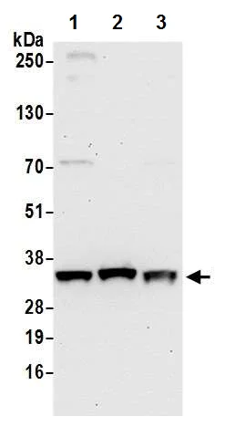 Western blot - Anti-PYCR1 antibody - C-terminal (AB226340)