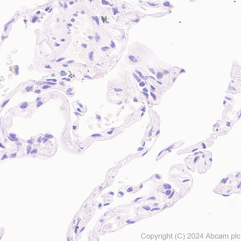 Immunohistochemistry (Formalin/PFA-fixed paraffin-embedded sections) - Anti-PYCR1 antibody [EPR28646-7] (AB317563)