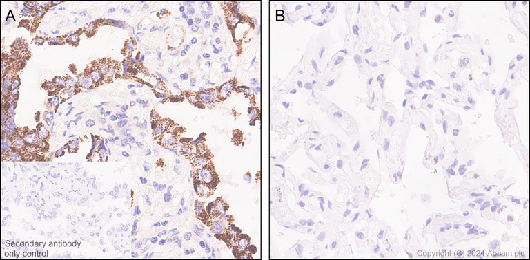 Immunohistochemistry (Formalin/PFA-fixed paraffin-embedded sections) - Anti-PYCR1 antibody [EPR28646-7] - BSA and Azide free (AB317564)