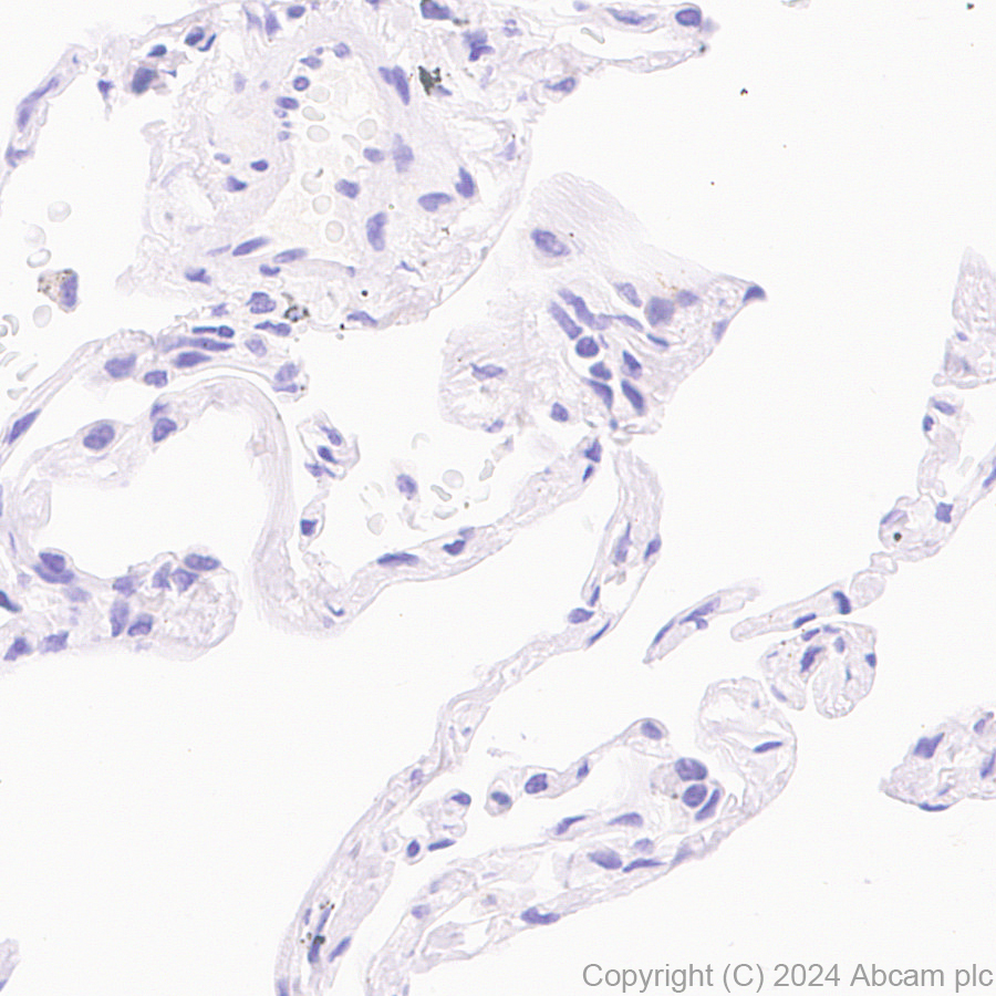 Immunohistochemistry (Formalin/PFA-fixed paraffin-embedded sections) - Anti-PYCR1 antibody [EPR28646-7] - BSA and Azide free (AB317564)