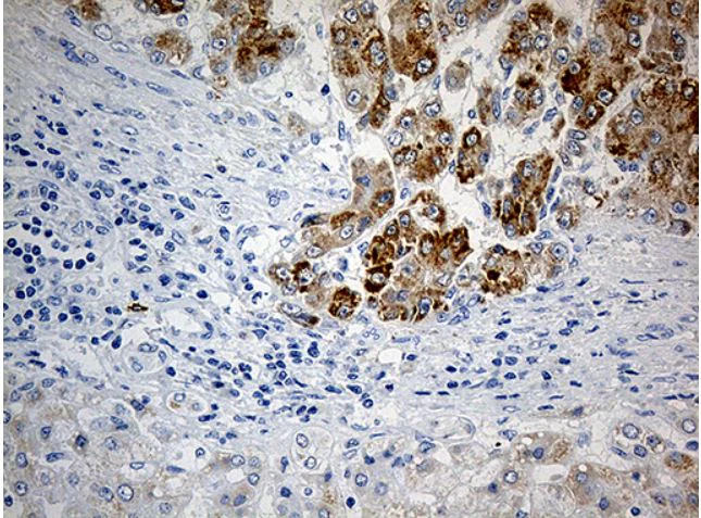 Immunohistochemistry (Formalin/PFA-fixed paraffin-embedded sections) - Anti-PYCR1 antibody [OTI4F2] (AB279385)