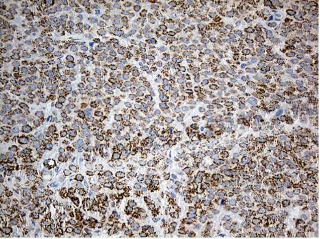 Immunohistochemistry (Formalin/PFA-fixed paraffin-embedded sections) - Anti-PYCR1 antibody [OTI4F2] (AB279385)