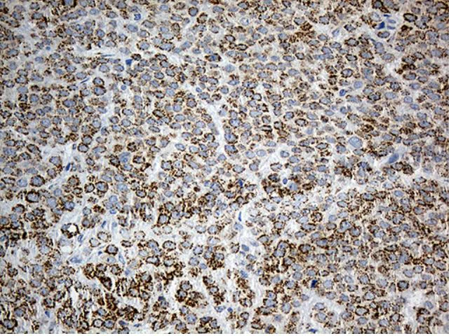 Immunohistochemistry (Formalin/PFA-fixed paraffin-embedded sections) - Anti-PYCR1 antibody [OTI4F2] (AB279385)
