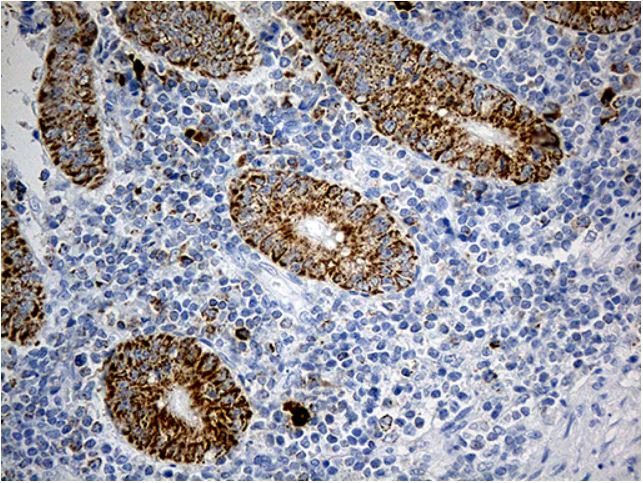Immunohistochemistry (Formalin/PFA-fixed paraffin-embedded sections) - Anti-PYCR1 antibody [OTI4F2] (AB279385)