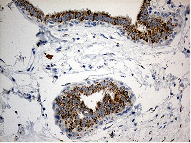 Immunohistochemistry (Formalin/PFA-fixed paraffin-embedded sections) - Anti-PYCR1 antibody [OTI4F2] (AB279385)