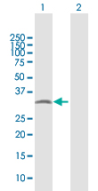Western blot - Anti-PYCR2 antibody (AB103535), expandable thumbnail