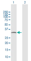 Western blot - Anti-PYCR2 antibody (AB103535)