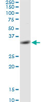 Western blot - Anti-PYCR2 antibody (AB103535), expandable thumbnail