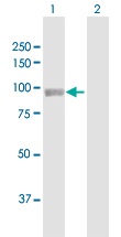 Western blot - Anti-PYGL antibody (AB103419)