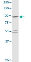 Western blot - Anti-PYGL antibody (AB103419)