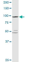 Western blot - Anti-PYGL antibody (AB103419)