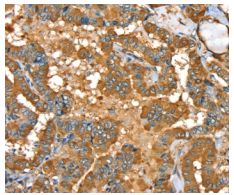 Immunohistochemistry (Formalin/PFA-fixed paraffin-embedded sections) - Anti-PYGL antibody (AB198268), expandable thumbnail