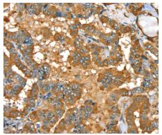 Immunohistochemistry (Formalin/PFA-fixed paraffin-embedded sections) - Anti-PYGL antibody (AB198268)